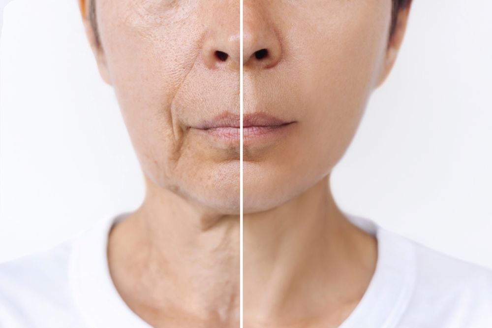 wrinkle expert coeur d'alene